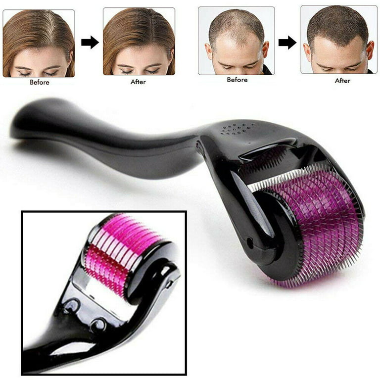 3-in-1 Facial Roller Combo – Jade Roller, Ice Roller & Derma Roller