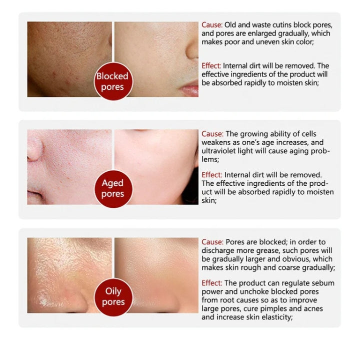 Rorec Rice Moisturizing Anti-Wrinkle Face Serum