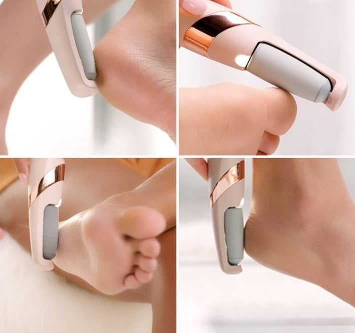 Electric Foot Callus Remover – 2-in-1 Fine & Coarse Roller for Smooth, Soft Feet