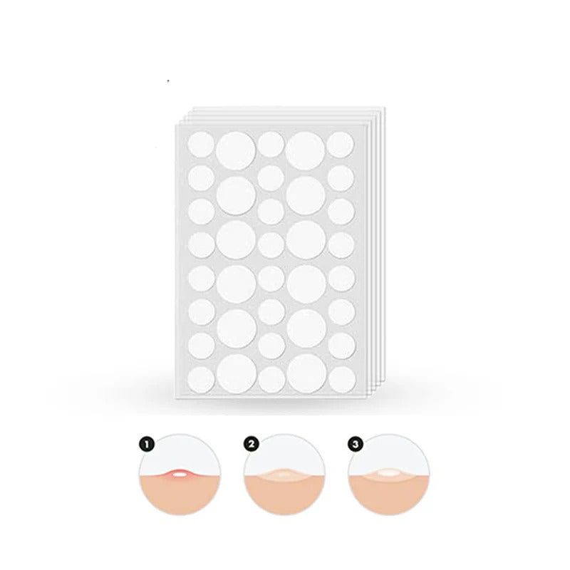 Glamorous Face Acne Pimple Patch